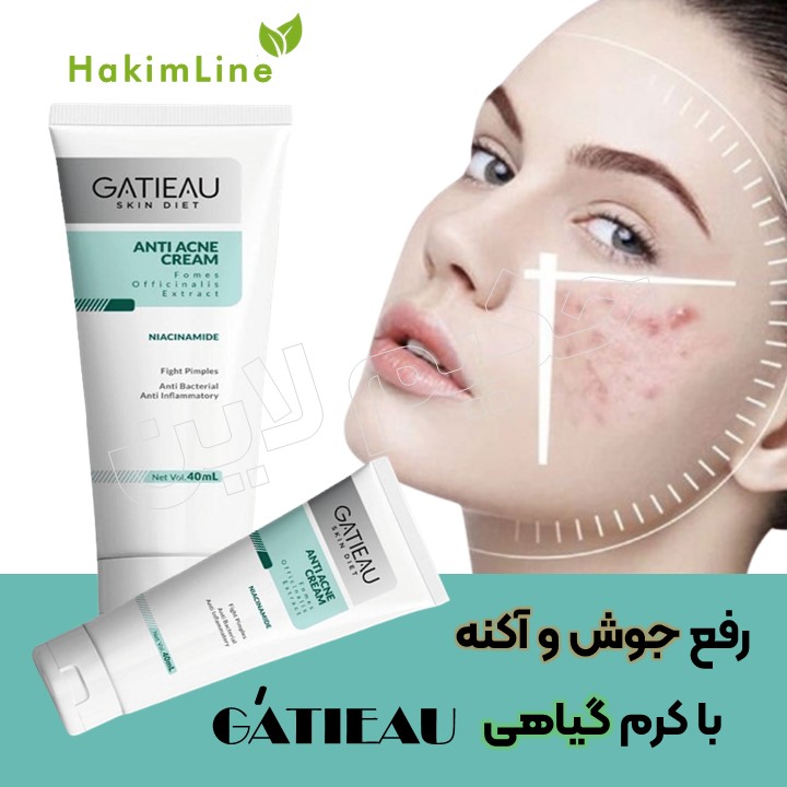 Gatio Anti-Acne Cream